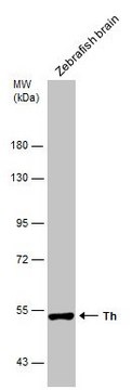 Anti-th antibody produced in rabbit