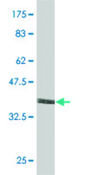 ANTI-RIPK4 antibody produced in mouse