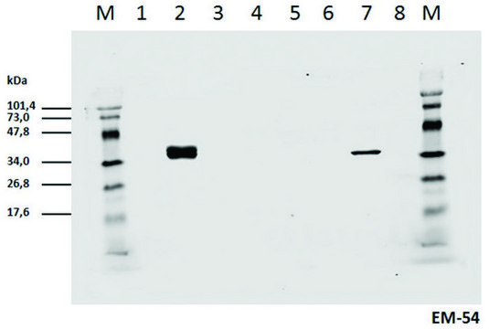 Monoclonal Anti-CD3 zeta (PhosphoTyr142) antibody