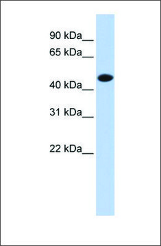 Anti-CKM (ab1) antibody produced in