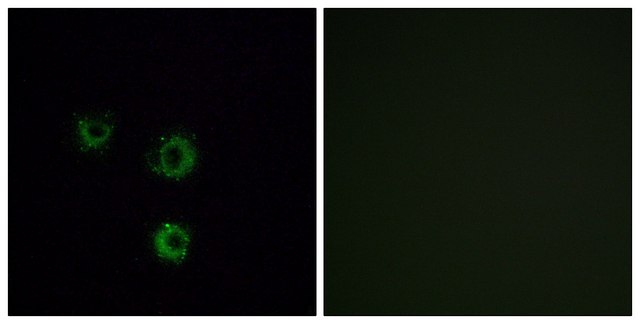 Anti-TAS2R14 antibody produced in rabbit