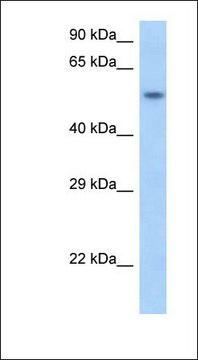 Anti-SNAPC1 antibody produced in rabbit