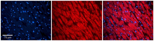 Anti-PKP2, (N-terminal) antibody produced in