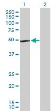 Anti-TUBB1 antibody produced in rabbit