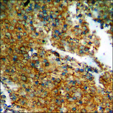 Anti-phospho-Catenin-? (pThr?¹/Ser??) antibody produced in