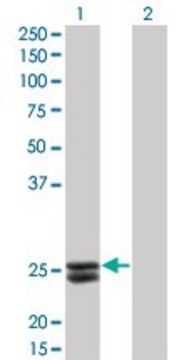 Monoclonal Anti-PRL, (C-terminal) antibody produced
