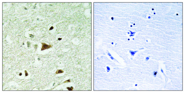 Anti-SMAD2 antibody produced in rabbit