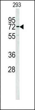 ANTI-CEA (CENTER) antibody produced in