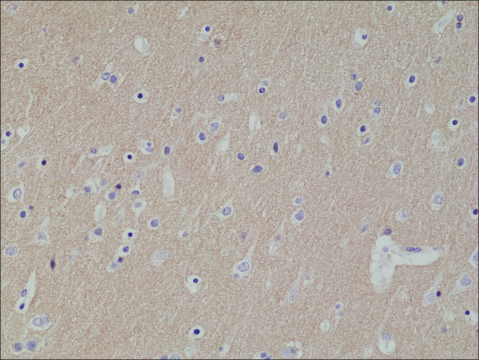 Anti-CD56 antibody, Rabbit monoclonal