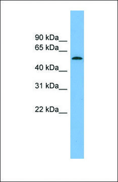 Anti-GLCCI1 antibody produced in rabbit