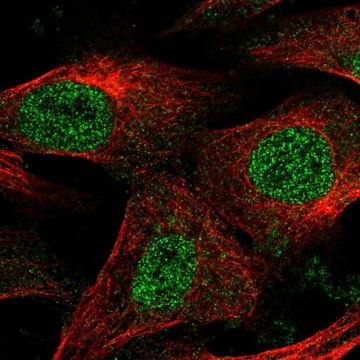 Anti-EPM2A antibody produced in rabbit