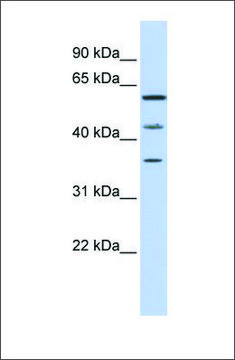 Anti-PHF23 antibody produced in rabbit