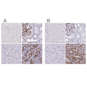 Anti-PITPNM3 antibody produced in rabbit