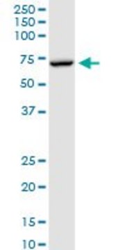 Anti-MTM1 antibody produced in rabbit
