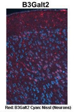 Anti-B3GALT2 antibody produced in rabbit