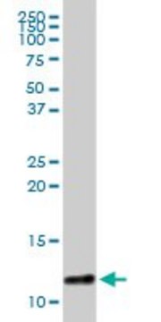 Anti-S100A8 antibody produced in rabbit