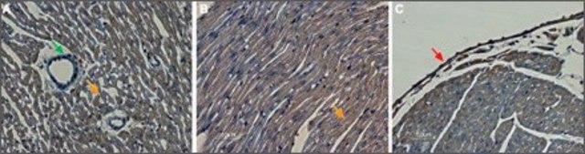 Anti-Potassium Channel K?11.1 Extracellular antibody