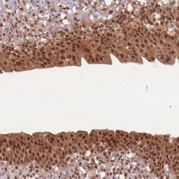 Anti-UBB antibody produced in rabbit