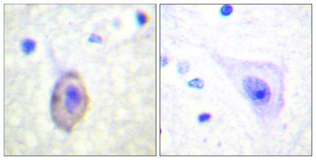 Anti-VEGFR1 antibody produced in rabbit