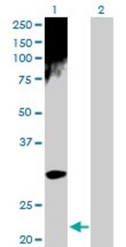 Anti-ARD1A antibody produced in rabbit