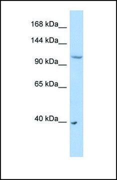 Anti-NEDD4L antibody produced in rabbit