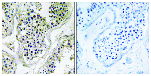 Anti-ATXN7L1 antibody produced in rabbit