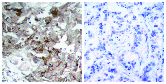 Anti-Cortactin antibody produced in rabbit
