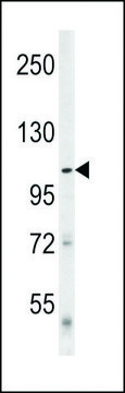 ANTI-DENATURED ATG1 antibody produced in