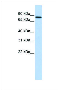 Anti-ADARB2 antibody produced in rabbit