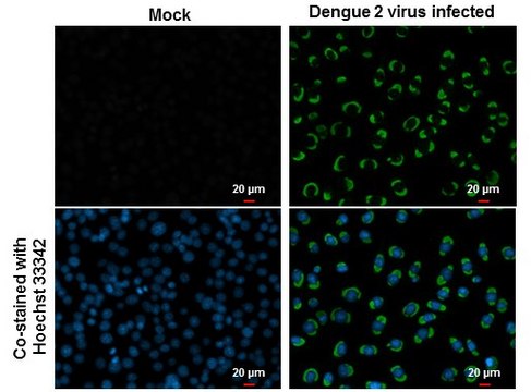 Monoclonal Anti-Dengue virus NS1 protein
