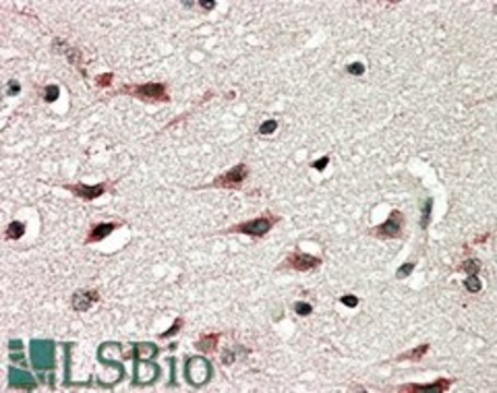 Anti-DYX1C1 (Isoform A) antibody produced