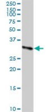 Anti-CBR3 antibody produced in rabbit