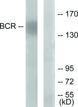 Anti-BCR antibody produced in rabbit