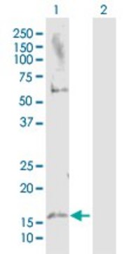 Anti-MAP1LC3A antibody produced in rabbit