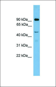 Anti-ZFY2 antibody produced in rabbit