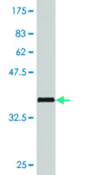 Monoclonal Anti-HADHSC, (C-terminal) antibody produced