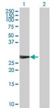 Anti-KIRREL2 antibody produced in rabbit