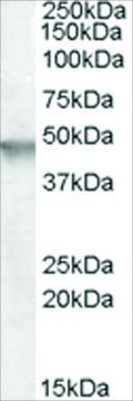 Anti-ARNO/Cytohesion 2 antibody produced in