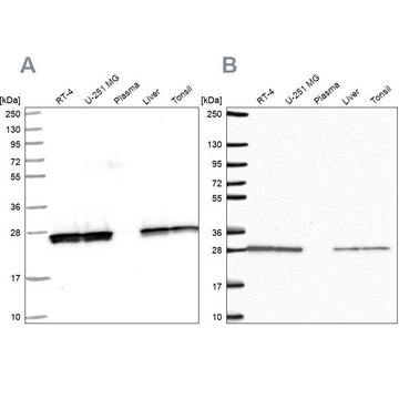Anti-TPI1 antibody produced in rabbit