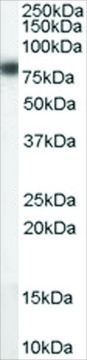 Anti-CPT1A antibody produced in goat