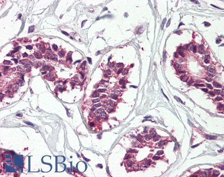 Anti-IGF2BP1 antibody produced in goat