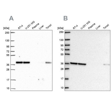 Anti-NUP37 antibody produced in rabbit