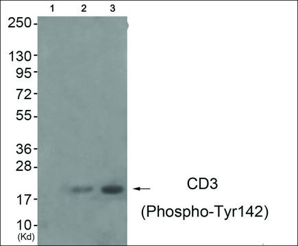 Anti-phospho-CD3 ? (pTyr¹?²) antibody produced