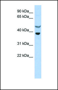 Anti-SOCS7, (N-terminal) antibody produced in