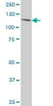 ANTI-ERN1 antibody produced in mouse