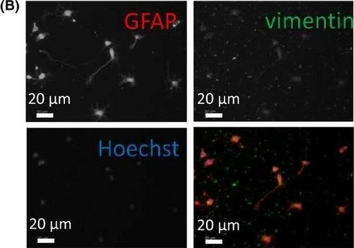 Anti-Vimentin antibody produced in rabbit