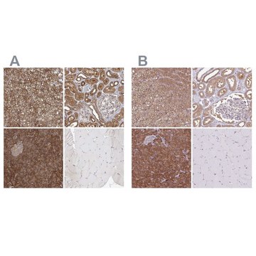 Anti-PACSIN2 antibody produced in rabbit