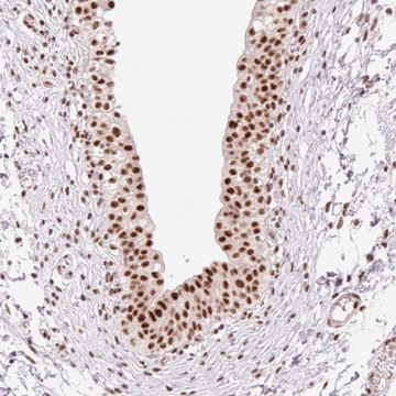 Anti-PRDM11 antibody produced in rabbit