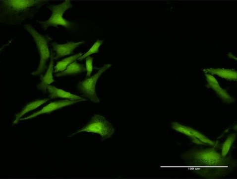 Anti-C1orf38 antibody produced in rabbit