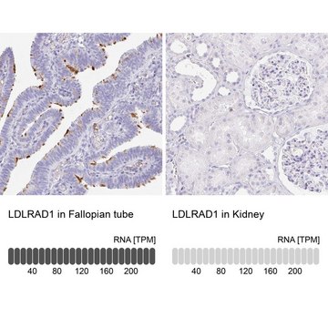 Anti-LDLRAD1 antibody produced in rabbit